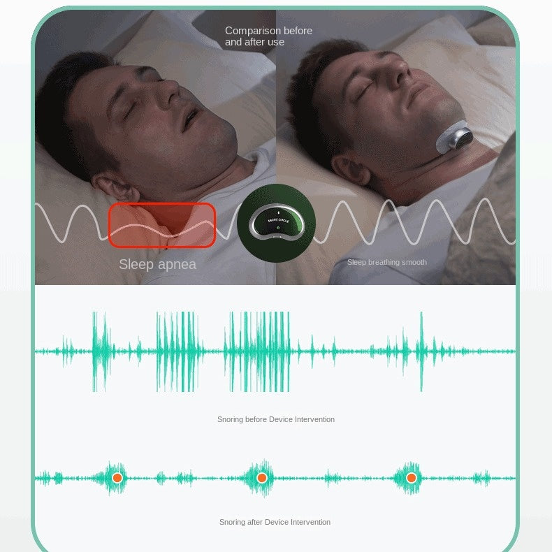 AI artificial intelligence anti snoring device for home business travel sleeping anti snoring and anti snoring