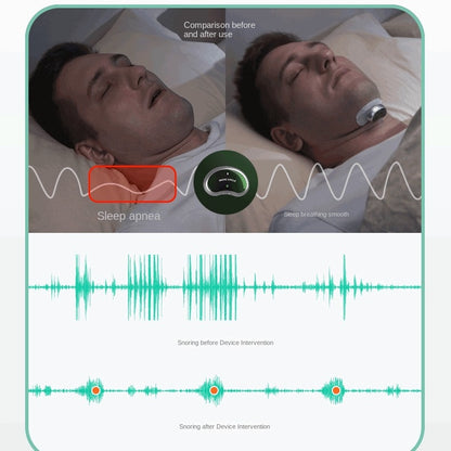 AI artificial intelligence anti snoring device for home business travel sleeping anti snoring and anti snoring