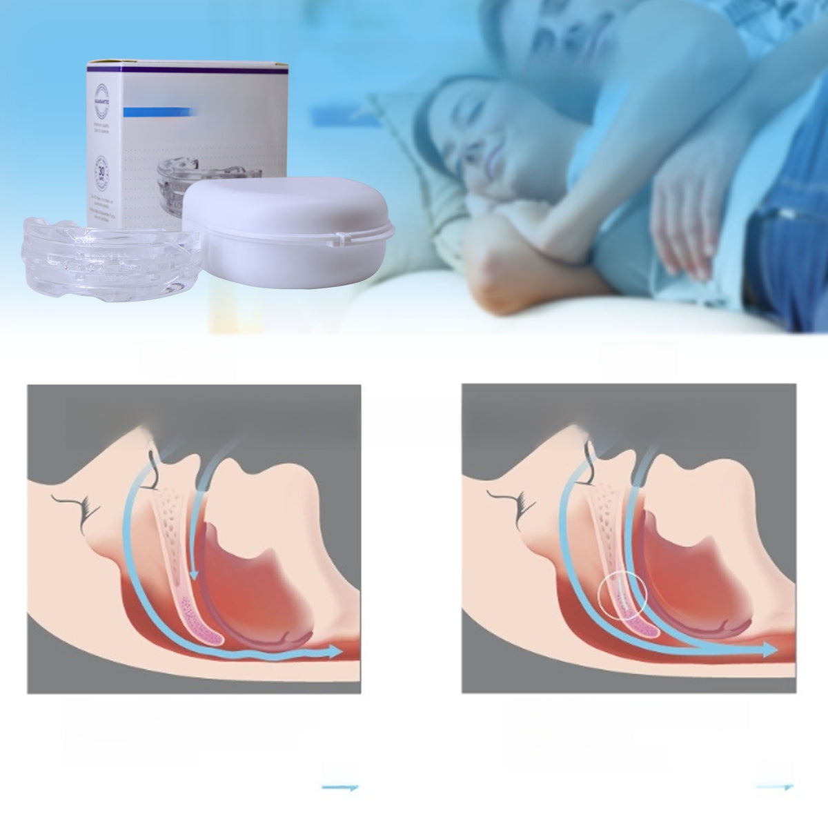 Adjustable Heat-Moldable Anti-Snoring Mouthpiece