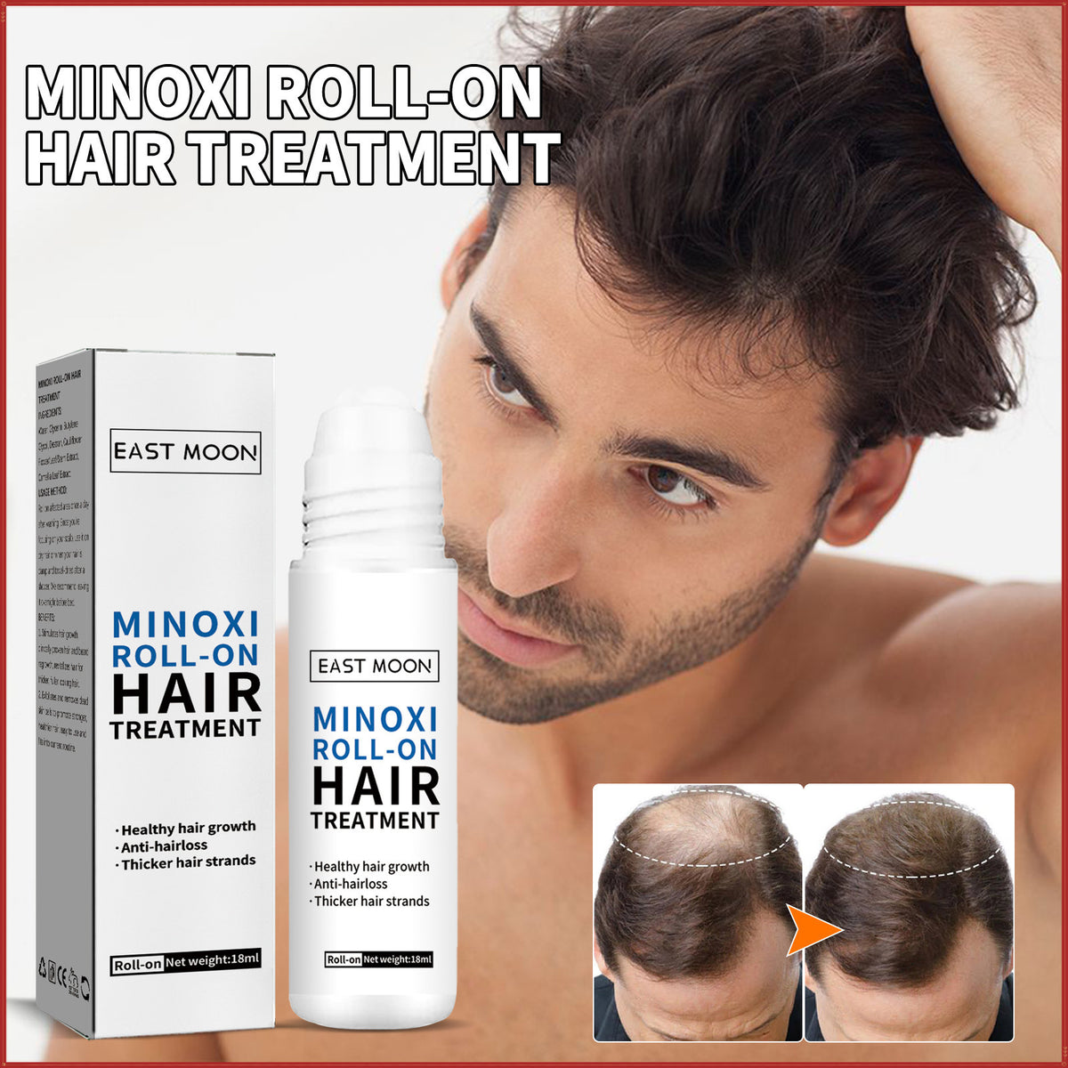 East Moon Roller Ball Hair Density & Hairline Repair Oil (18ml)