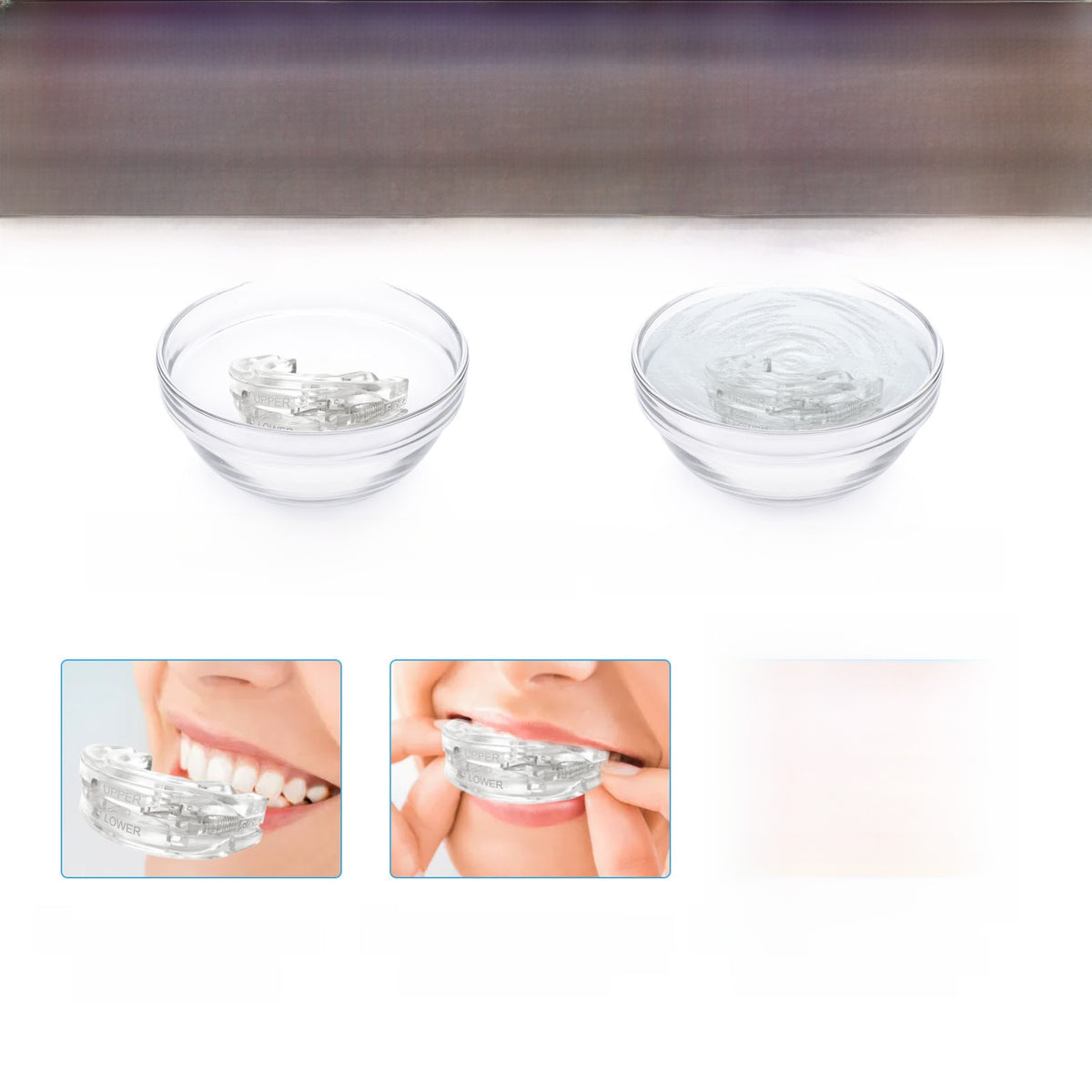 Adjustable Heat-Moldable Anti-Snoring Mouthpiece